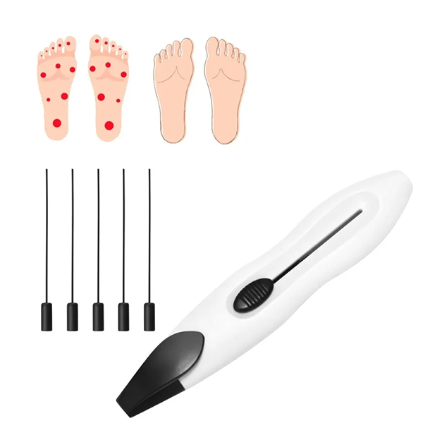 قلم فحص القدم السكري – جهاز كشف الاعتلال العصبي بالخيوط الأحادية